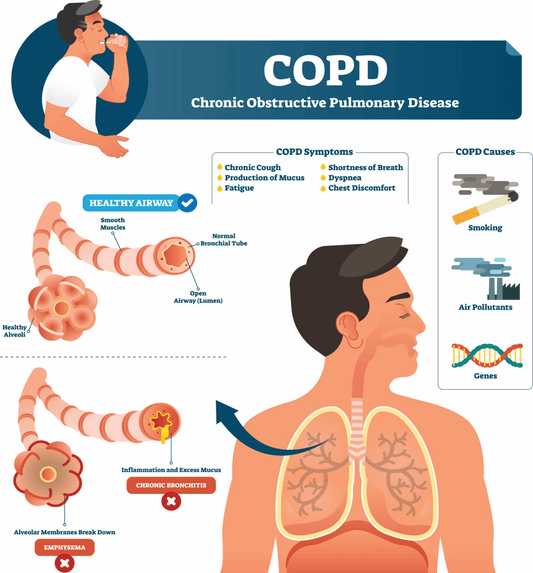 How RAAROXY Oxygen Concentrators Help COPD Patients